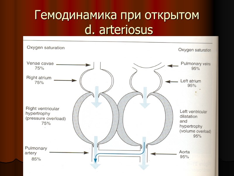 Гемодинамика при открытом  d. arteriosus